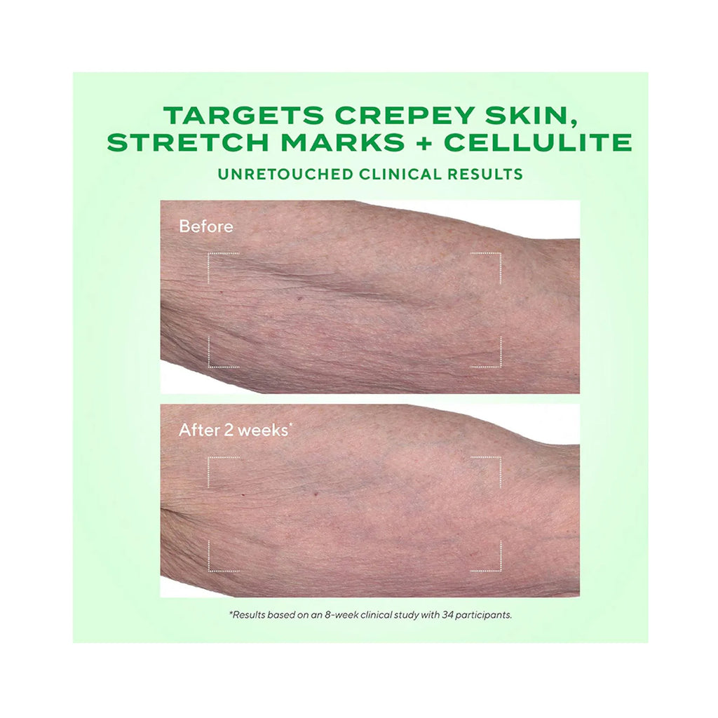 Murad - Retinal ReSculpt Body Treatment - Lift, Verstevig en Verstrak de Huid