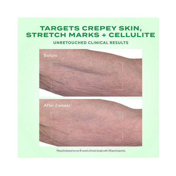 Murad - Retinal ReSculpt Body Treatment - Lift, Verstevig en Verstrak de Huid