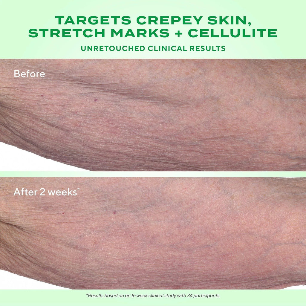 Murad - Retinal ReSculpt Body Treatment - Lift, Verstevig en Verstrak de Huid