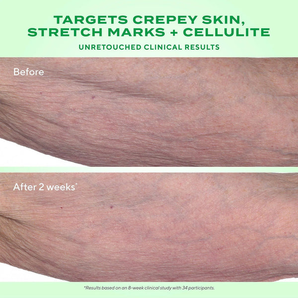 Murad - Retinal ReSculpt Body Treatment - Lift, Verstevig en Verstrak de Huid