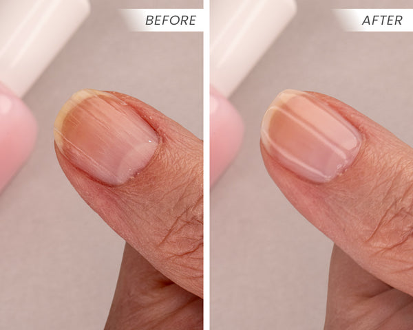 Zoya Naked Manicure - Pro Nail Perfecting Kit – Perfecte Natuurlijke Nagels in Minuten