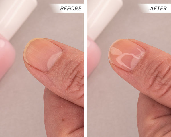 Zoya Naked Manicure - Pro Nail Perfecting Kit – Perfecte Natuurlijke Nagels in Minuten