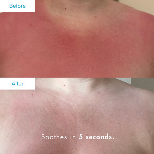 The Organic Pharmacy - After Sun Lotion