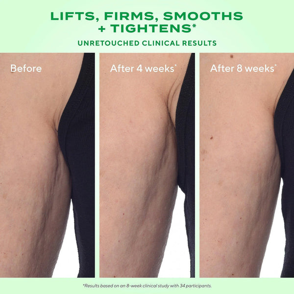 Murad - Retinal ReSculpt Body Treatment - Lift, Verstevig en Verstrak de Huid