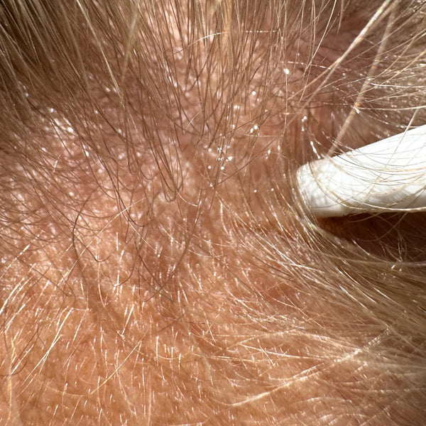 SoKind Pure Growth – Natuurlijke haargroei serum voor vrouwen