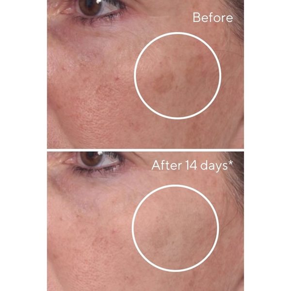 Murad - Exfoliate en Brighten