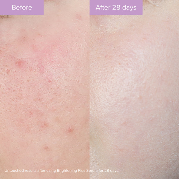 The Organic Pharmacy - Brightening Plus Serum