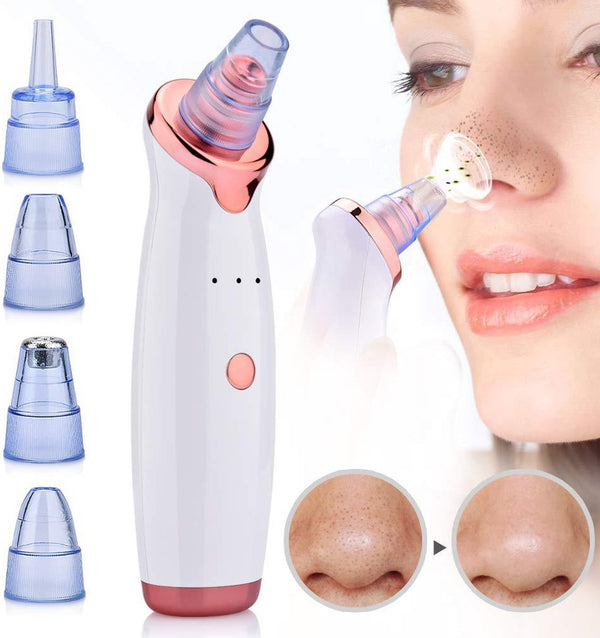 Paloma Beauties - Oplaadbare Mee-eter Verwijderaar - Dieptereiniging voor thuis
