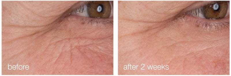 Dermalogica - Dynamisches Haut -Retinol -Serum