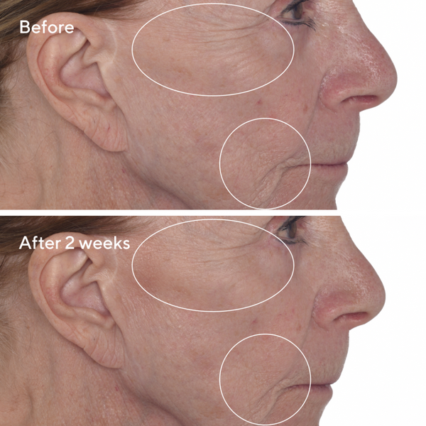 Murad -  Retinal ReSculpt Eye Treatment