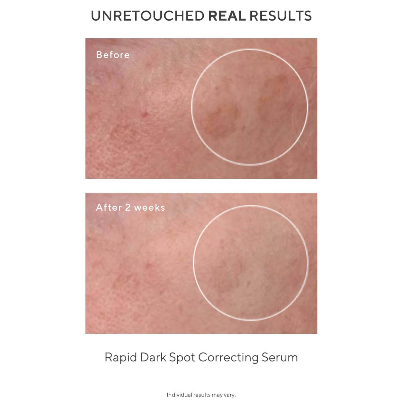 Murad - The Dark Spot Correctors - Beauty Junkies