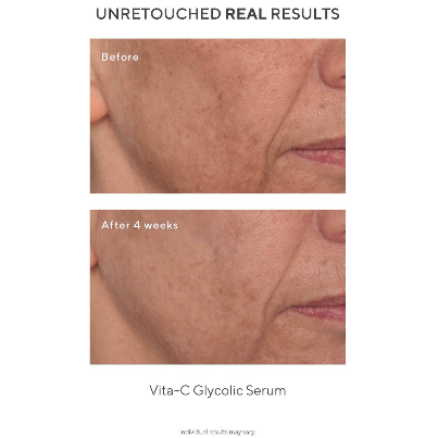 Murad - The Dark Spot Correctors - Beauty Junkies