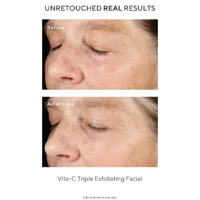 Murad - The Dark Spot Correctors - Beauty Junkies