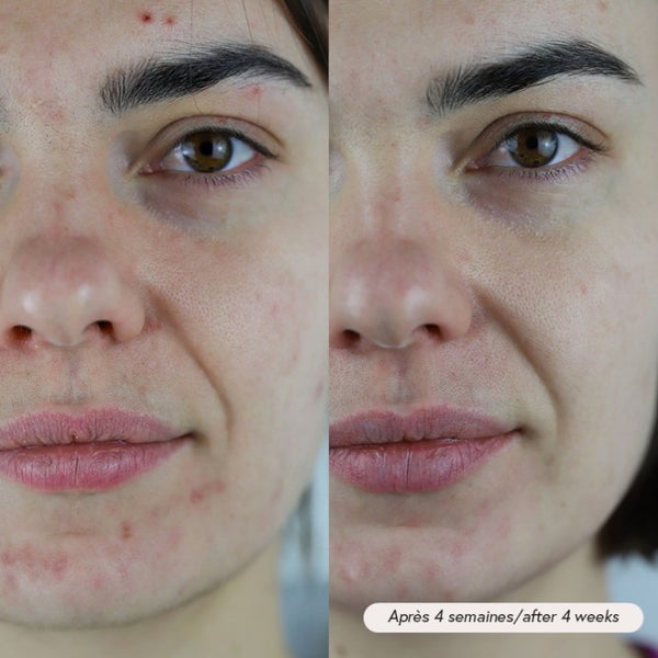 Absolution Cosmetics - PAX facial oil Travelsize