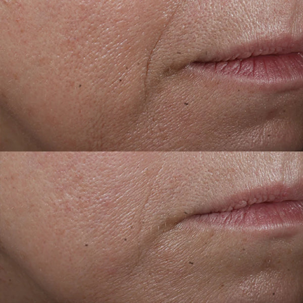 Perricone MD - Cold Plasma Plus+ - Alles-in-één anti-aging crème