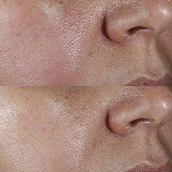 Perricone MD - No Rinse Intensive Pore Minimizing Toner