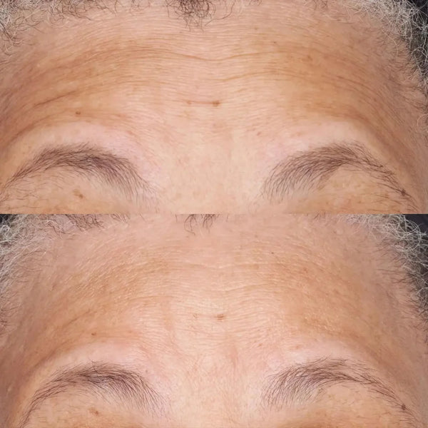 Perricone MD - Hypoallergenic Clean Correction Barrier Repair Nourishing Moisturizer