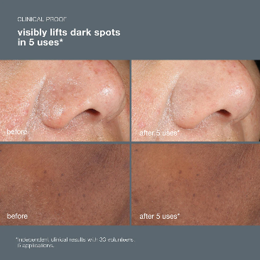 Dermalogica - Power Bright Dark Spot Peel