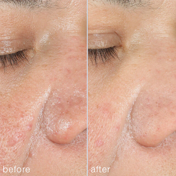 Dermalogica - Power Bright Dark Spot Peel