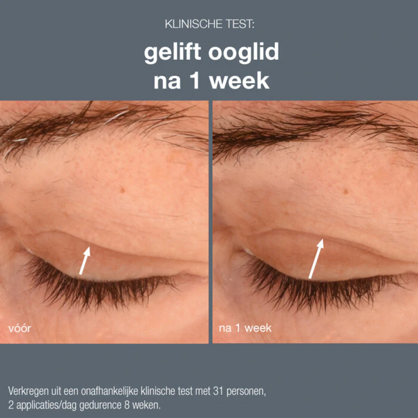 Dermalogica - Phyto Nature Lifting Eye Cream