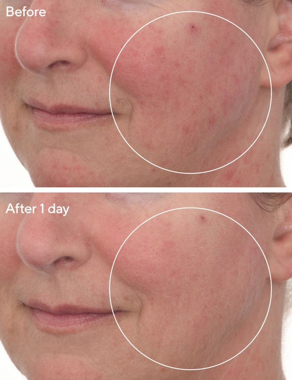 Murad - Cellular Hydration Barrier Repair Mask - Beauty Junkies