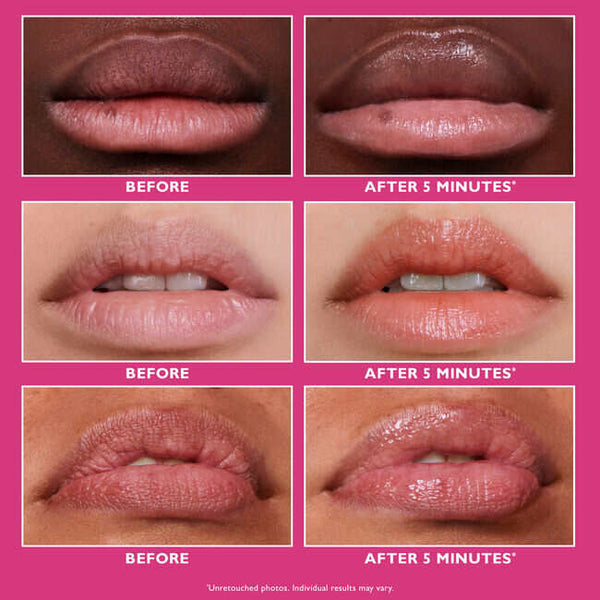 Peter Thomas Roth - Sofortiger fester Lippenfüller