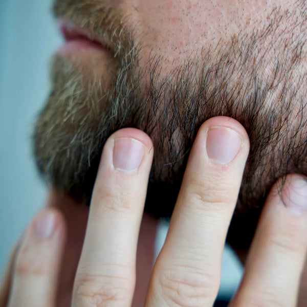 Better Be Bold Magic Bald Head & Beard Oil – voor hoofdhuid & baardverzorging
