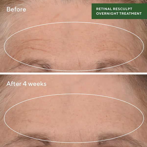 Murad -Retinal ReSculpt™ Overnight Treatment - Beauty Junkies