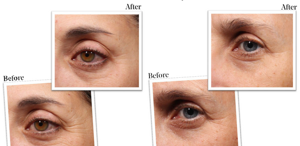 Murad -Targeted Wrinkle Corrector - Beauty Junkies