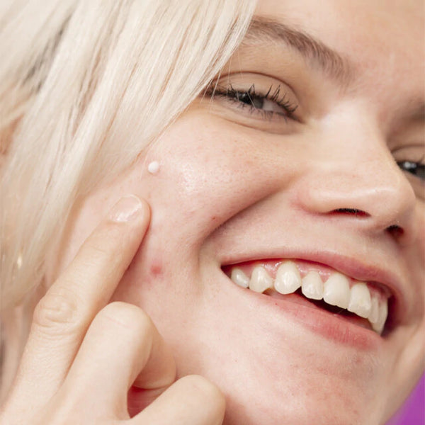 Dermalogica-Post-Breakout Fix spot treatment