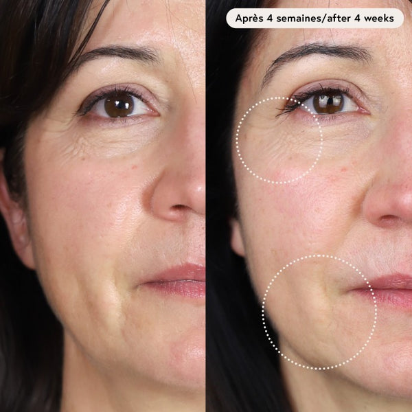 Voor- en nafoto van huidverslapping na 4 weken met Le Masque du Temps