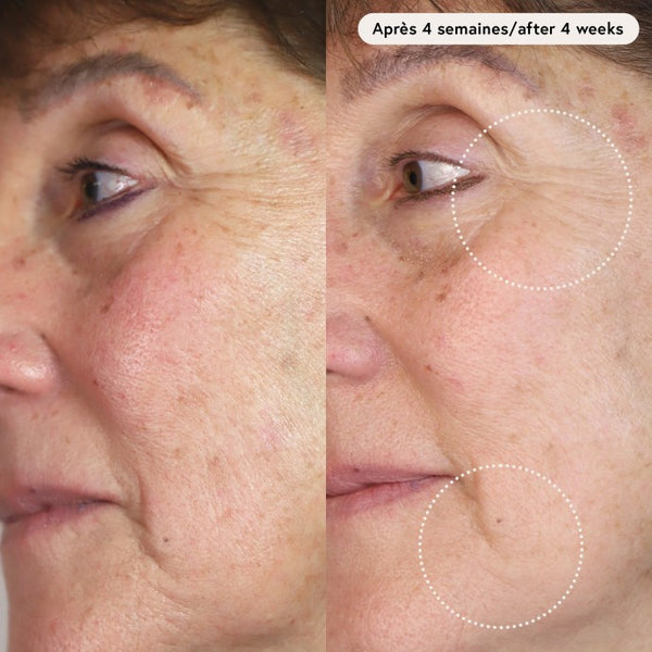 Voor- en nafoto van kraaienpootjes na 4 weken met Le Masque du Temps