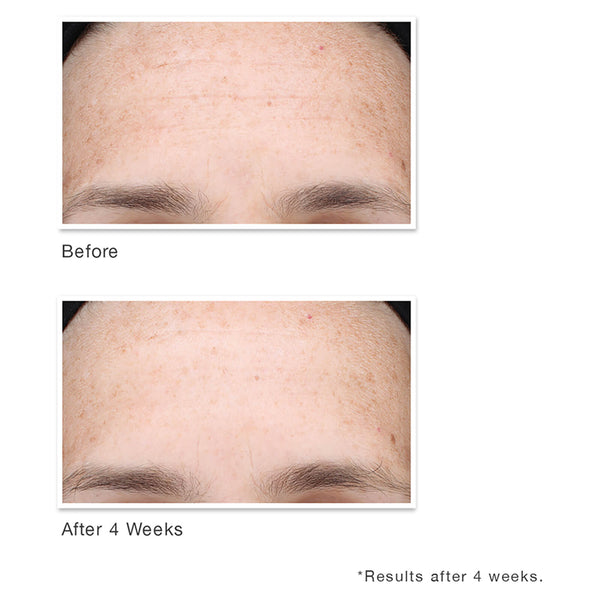 Murad - Multi-Vitamin Infusion Oil - Gezonde glow - Beauty Junkies