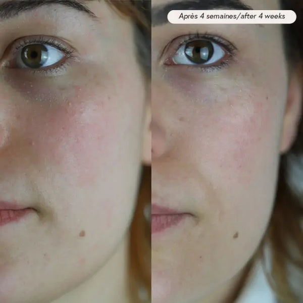 Voor- en na foto van huid na 4 weken gebruik van PAX Huidolie, zichtbaar verbeterde hydratatie en stralende teint