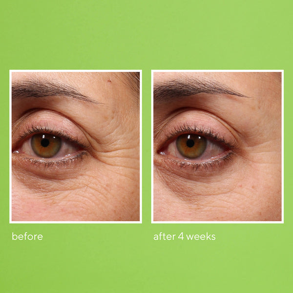 Murad - Retinol Youth Renewal Eye Serum - Rimpels en kraaienpootjes - Beauty Junkies