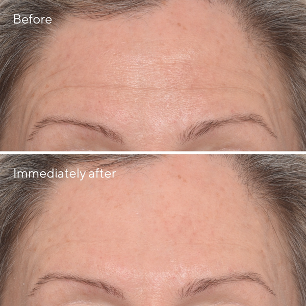 Murad - Targeted Wrinkle Corrector - Beauty Junkies