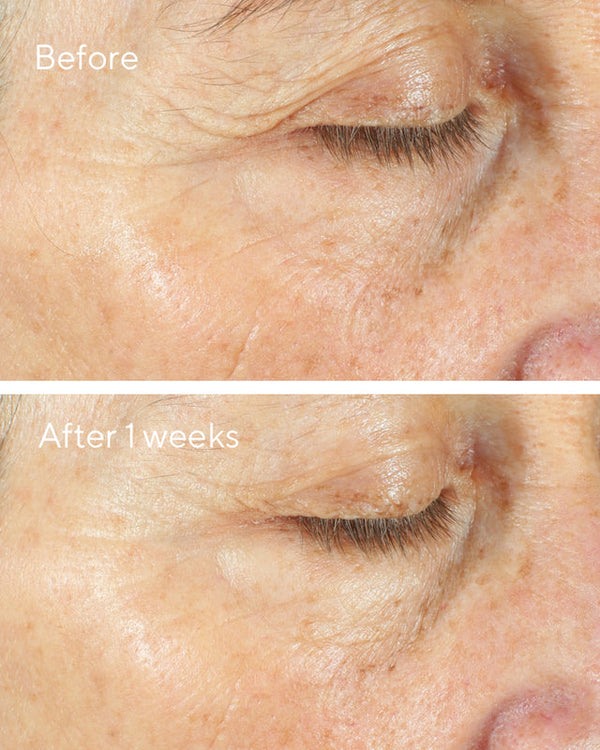 Murad - Intense Recovery Cream - Ultra-rijke crème - Voor super-gestreste huid - Beauty Junkies