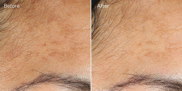 Murad - Vita-C Triple Exfoliating Facial - Exfoliater en Masker - Beauty Junkies