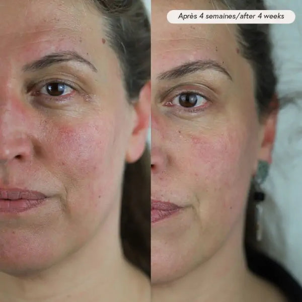 Voor- en na foto van huid na 4 weken gebruik van PAX Huidolie, met minder roodheid en een stralende glow.