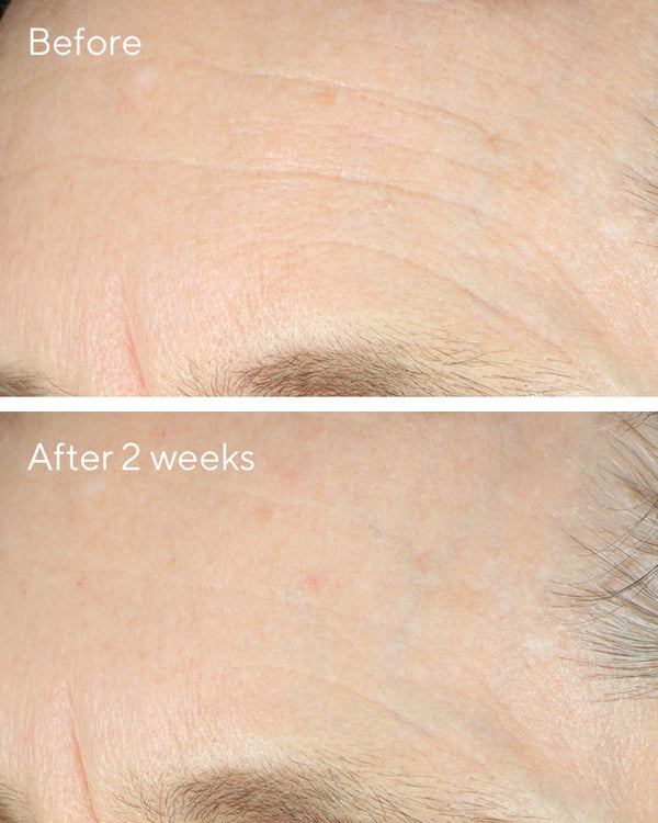 Murad - Intense Recovery Cream - Ultra-rijke crème - Voor super-gestreste huid - Beauty Junkies