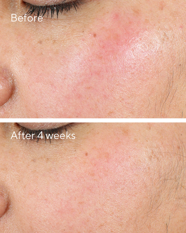 Murad - Intense Recovery Cream - Ultra-rijke crème - Voor super-gestreste huid - Beauty Junkies