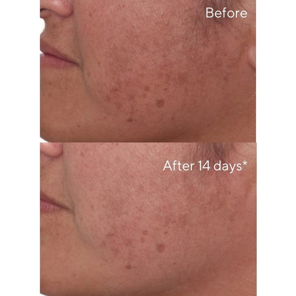 Murad - Exfoliate en Brighten