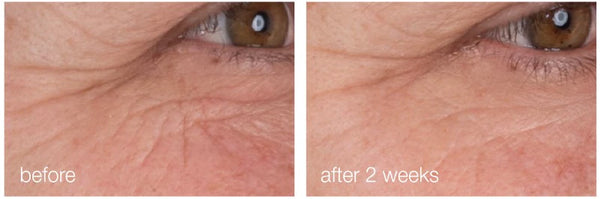 Dermalogica - Dynamic Skin Retinol Serum