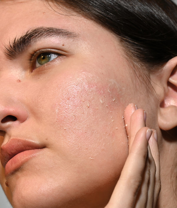 Dr. Schrammek - Triple Effect Peeling - 3-in-1 Peeling voor een Gladde & Stralende Huid 50ml