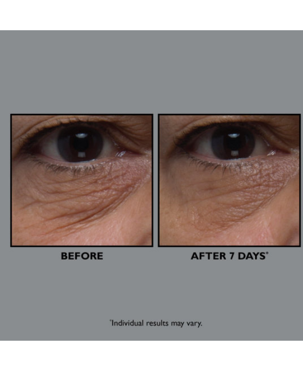 Peter Thomas Roth - FirmX Collagen Eye Cream - Beauty Junkies